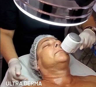 Ultra derma therapy